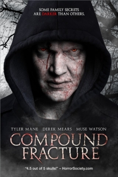 Poster Compound Fracture