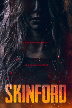 Poster Skinford