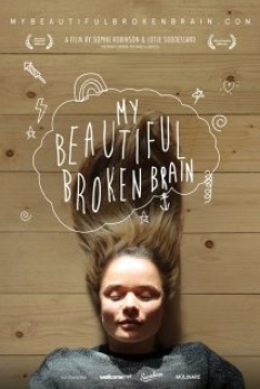 Poster My Beautiful Broken Brain