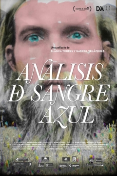 Poster Análisis De Sangre Azul