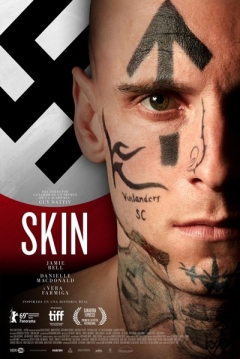 Poster Skin